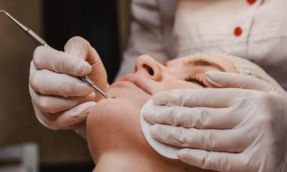 Laser treatment at Neoskyn