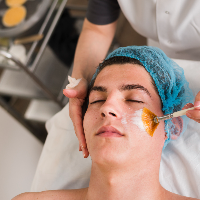 Peels Treatment